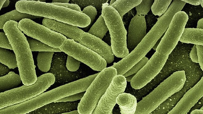 ¿Qué es la Legionella y cómo se produce?