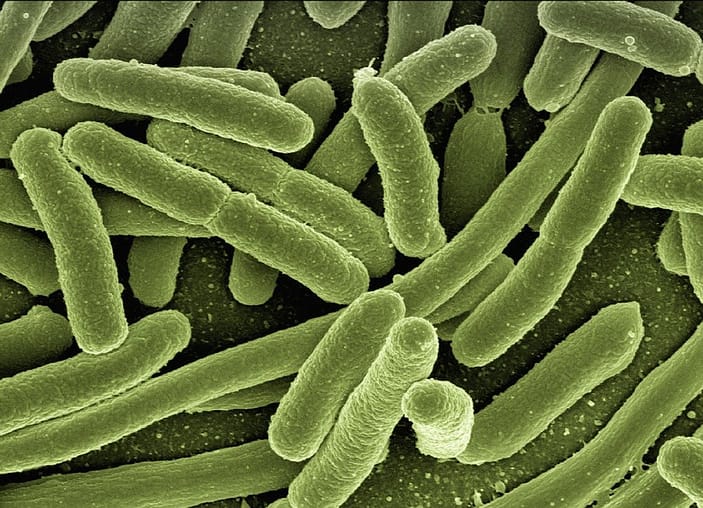 ¿Qué es la Legionella y cómo se produce?